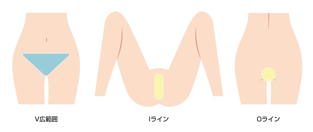 医療脱毛（女性脱毛）ハイジニーナセット  【公式】秋葉原中央 