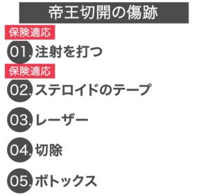 帝王切開の傷跡,01.注射を打つ、02.ステロイドのテープ、03.レーザー、04.切除、05.ボトックス