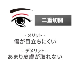 二重切開、メリット：傷が目立ちにくい、デメリット：あまり皮膚が取れない