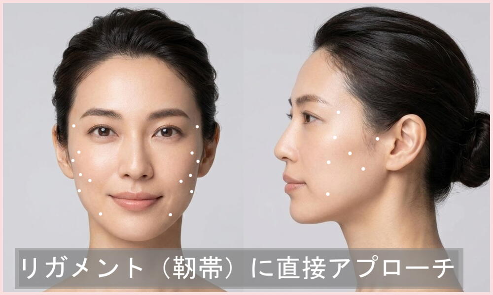 ジャルプロの注入箇所　正面と横から見た図