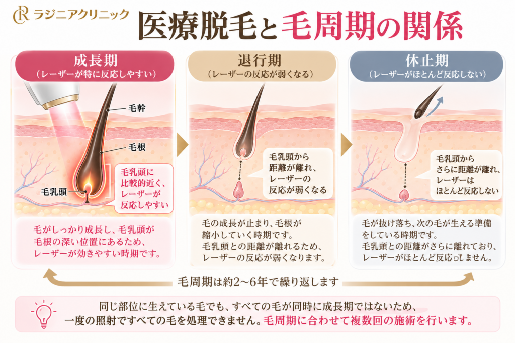 医療脱毛 毛周期 成長期 退行期 休止期 レーザー
