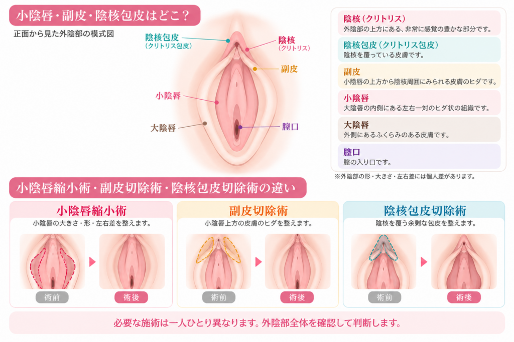 小陰唇縮小術 副皮切除術 陰核包皮切除術 違い